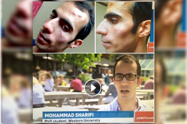 محمد شریفی در مصاحبه با سی بی سی گفته است که پس از حمله دو نفر در محل Covenant Garden Market در شهر لندن انتاریو دچار سر درد شدید و میگرن شده است.